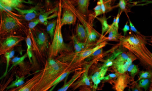 iCell Astrocytes