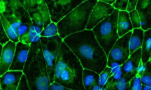 iCell Brain Microvascular Endothelial Cells