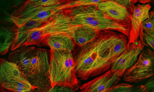 iCell Cardiomyocyte