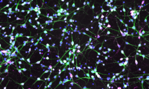 iCell Dopa Neuron TMEM175