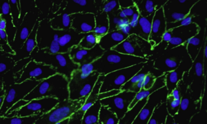 iCell Endothelial Cells