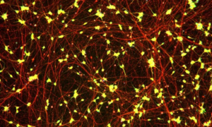 iCell Induced Excitatory Neurons