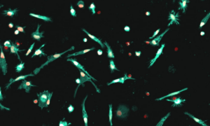iCell Microglia