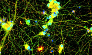 iCell Motor Neurons