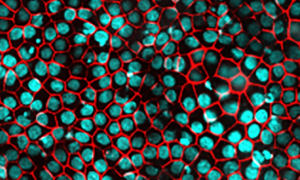 iCell Retinal Pigment Epithelial Cells