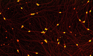 Human iPSC-derived Sensory Neurons
